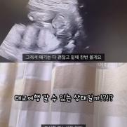박수홍♥김다예 임신 초음파 결과…"조산 가능성 無"